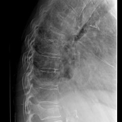 rx_colonna_dorsale_radiografie_domicilio_torino