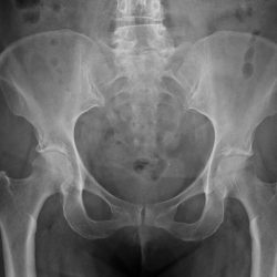 rx_bacino_radiografie_domicilio_biella-250x250 rx_bacino_radiografie_domicilio_biella-250x250