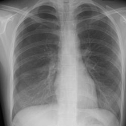 rx_torace_radiografie_domicilio_biella-250x250 rx_torace_radiografie_domicilio_biella-250x250