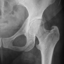 rx_anca_radiografie_domicilio_biella-250x250 rx_anca_radiografie_domicilio_biella-250x250