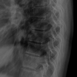 rx_colonna_dorsale_radiografie_domicilio_biella-1-250x250 rx_colonna_dorsale_radiografie_domicilio_biella-1-250x250