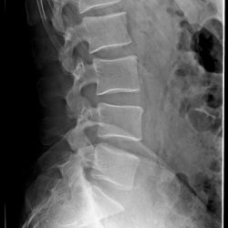 rx_sacrale_radiografie_domicilio_biella-250x250 rx_sacrale_radiografie_domicilio_biella-250x250